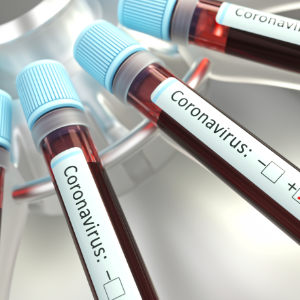 Coronatest